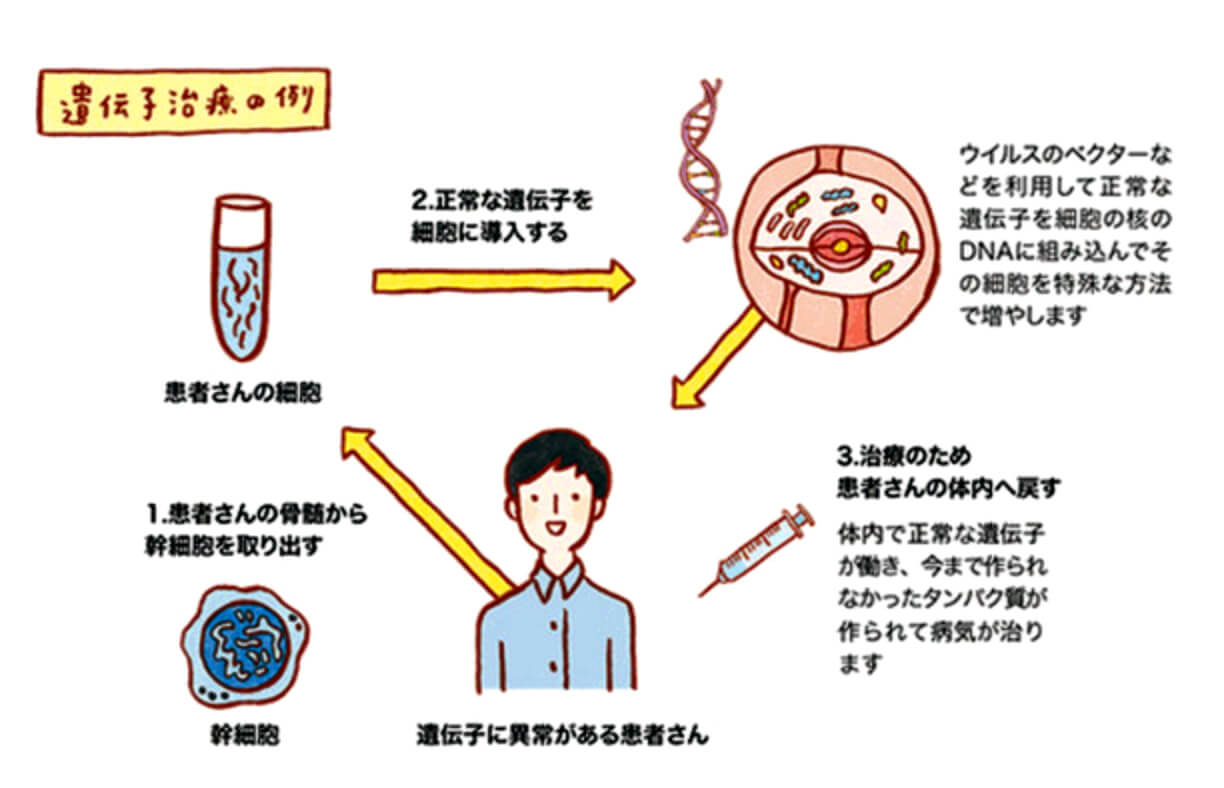 パートナーの浮気に悩んでいる方は遺伝子治療をご検討ください 院長ブログ 五本木クリニック